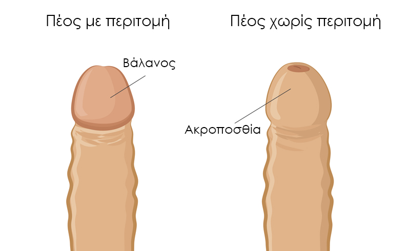 περιτομή